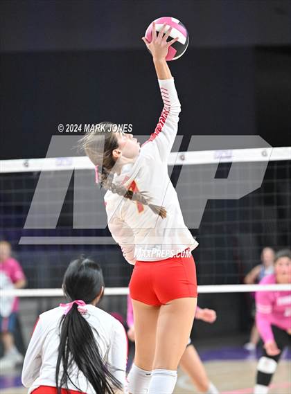 Thumbnail 2 in Seton Catholic @ Valley Christian (Dig for a Cure) photogallery.