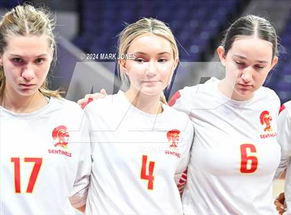 Thumbnail 1 in Seton Catholic @ Valley Christian (Dig for a Cure) photogallery.