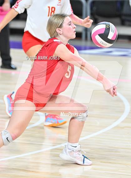 Thumbnail 3 in Seton Catholic @ Valley Christian (Dig for a Cure) photogallery.