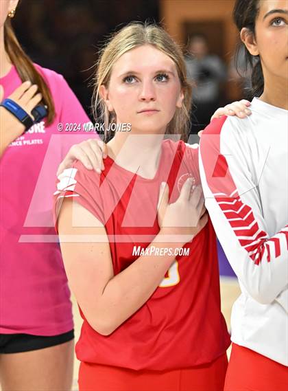 Thumbnail 1 in Seton Catholic @ Valley Christian (Dig for a Cure) photogallery.