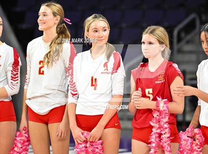 Thumbnail 1 in Seton Catholic @ Valley Christian (Dig for a Cure) photogallery.