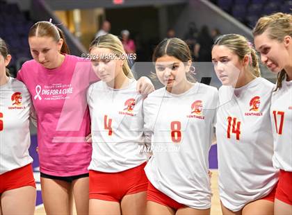 Thumbnail 1 in Seton Catholic @ Valley Christian (Dig for a Cure) photogallery.