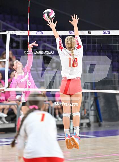 Thumbnail 1 in Seton Catholic @ Valley Christian (Dig for a Cure) photogallery.