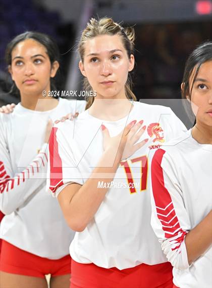 Thumbnail 2 in Seton Catholic @ Valley Christian (Dig for a Cure) photogallery.