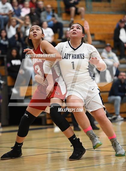 Thumbnail 3 in Madison vs. Hoover (CIF SDS D5 Final) photogallery.