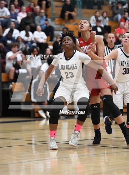 Thumbnail 1 in Madison vs. Hoover (CIF SDS D5 Final) photogallery.
