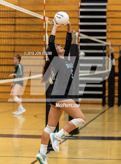 Thumbnail 1 in Buena vs Clovis East photogallery.
