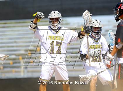 Thumbnail 2 in Harvard-Westlake vs. Peninsula photogallery.