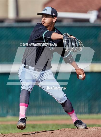 Thumbnail 2 in McClatchy vs. Granite Bay (Albie Swingin' for Life) photogallery.