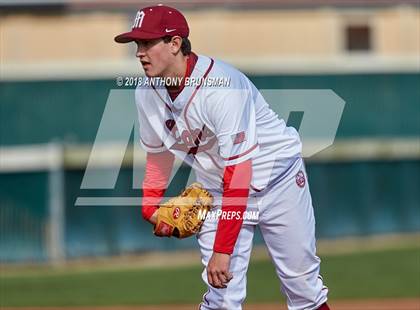Thumbnail 2 in McClatchy vs. Granite Bay (Albie Swingin' for Life) photogallery.