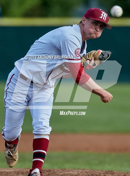 Thumbnail 1 in McClatchy vs. Granite Bay (Albie Swingin' for Life) photogallery.