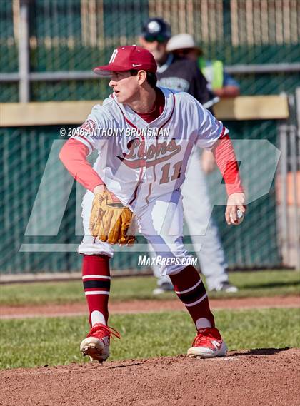 Thumbnail 3 in McClatchy vs. Granite Bay (Albie Swingin' for Life) photogallery.