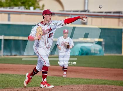 Thumbnail 1 in McClatchy vs. Granite Bay (Albie Swingin' for Life) photogallery.