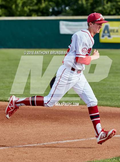 Thumbnail 1 in McClatchy vs. Granite Bay (Albie Swingin' for Life) photogallery.