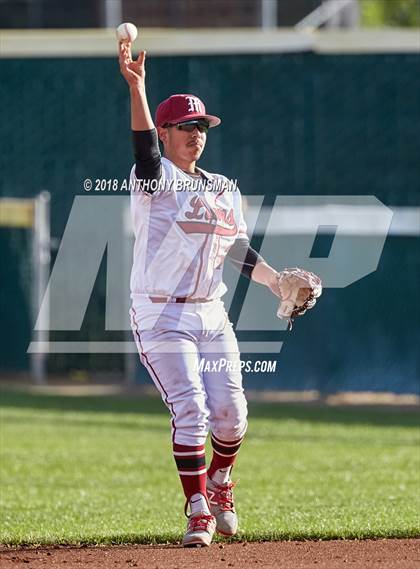 Thumbnail 1 in McClatchy vs. Granite Bay (Albie Swingin' for Life) photogallery.