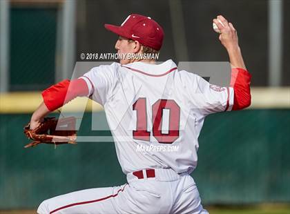 Thumbnail 3 in McClatchy vs. Granite Bay (Albie Swingin' for Life) photogallery.