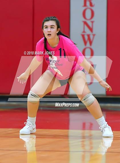 Thumbnail 1 in Centennial @ Ironwood photogallery.