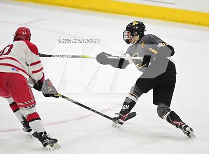 Thumbnail 2 in Amity Regional vs. Cheshire (CIAC DII Semifinal) photogallery.