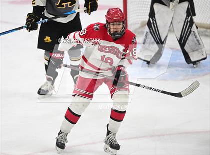 Thumbnail 2 in Amity Regional vs. Cheshire (CIAC DII Semifinal) photogallery.