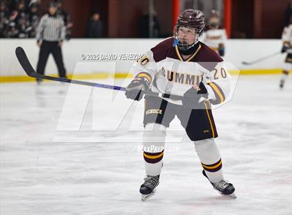 Thumbnail 3 in Summit @ morristown Beard photogallery.