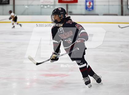 Thumbnail 1 in Summit @ morristown Beard photogallery.