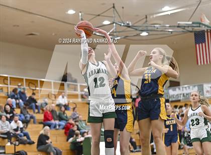 Thumbnail 2 in Delta @ Pendleton Heights photogallery.