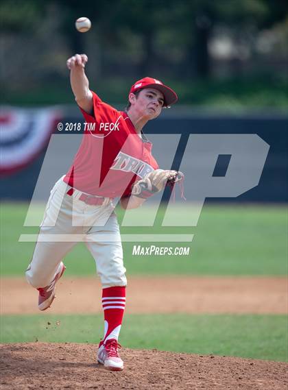 Thumbnail 3 in Dana Hills vs. Bountiful photogallery.