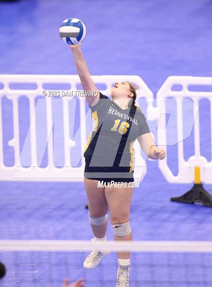 Thumbnail 3 in Endless Summer VB Tournament (Grand Varsity Champions) photogallery.