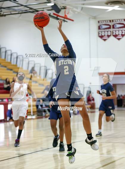 Thumbnail 3 in Hylton @ Unity Reed photogallery.