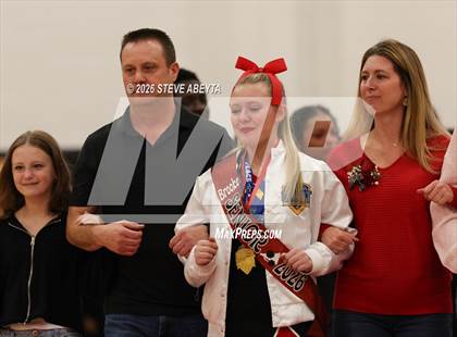 Thumbnail 3 in Arapahoe @ Eaglecrest photogallery.