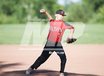 Thumbnail 3 in Hilton @ Pittsford photogallery.