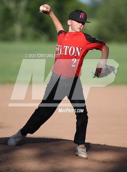 Thumbnail 3 in Hilton @ Pittsford photogallery.
