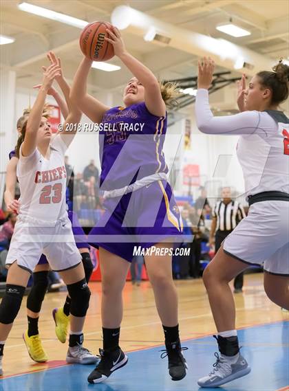 Thumbnail 1 in Tallwood @ Kempsville photogallery.