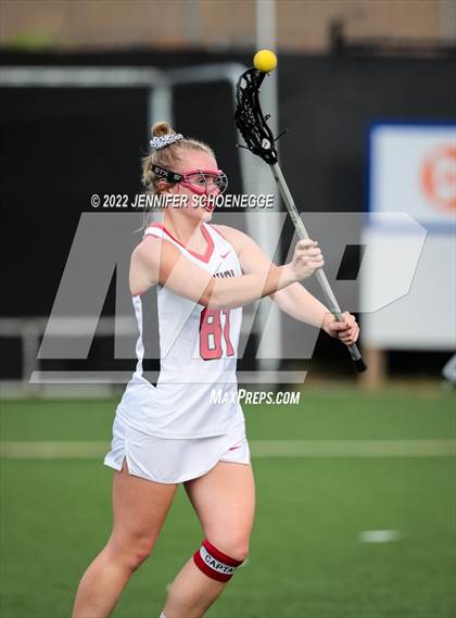 Thumbnail 2 in Mercy @ DuPont Manual photogallery.