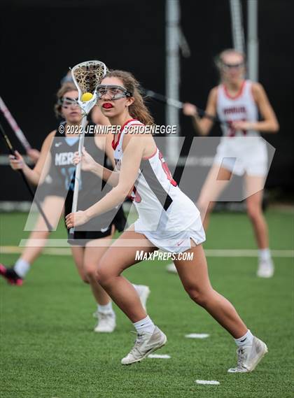 Thumbnail 3 in Mercy @ DuPont Manual photogallery.