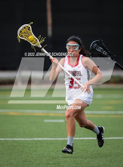 Thumbnail 1 in Mercy @ DuPont Manual photogallery.