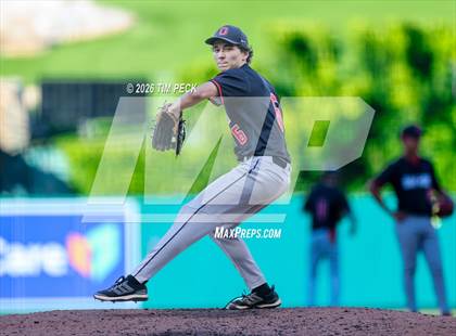 Thumbnail 1 in Hoover vs. Oakwood photogallery.