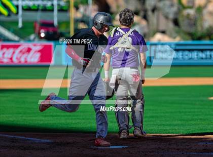 Thumbnail 1 in Hoover vs. Oakwood photogallery.