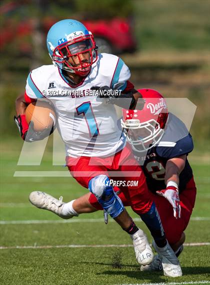 Thumbnail 3 in Kent Denver vs Manual photogallery.