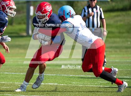 Thumbnail 1 in Kent Denver vs Manual photogallery.