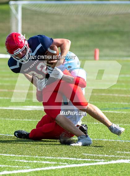 Thumbnail 3 in Kent Denver vs Manual photogallery.