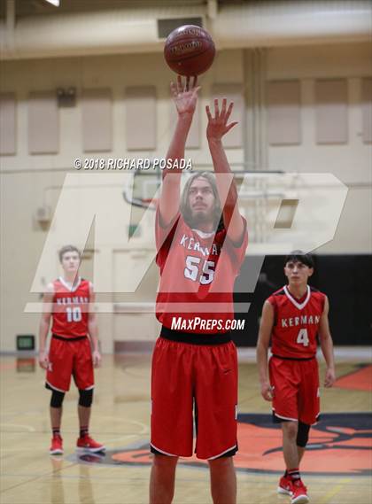 Thumbnail 1 in Kerman vs. Fresno photogallery.