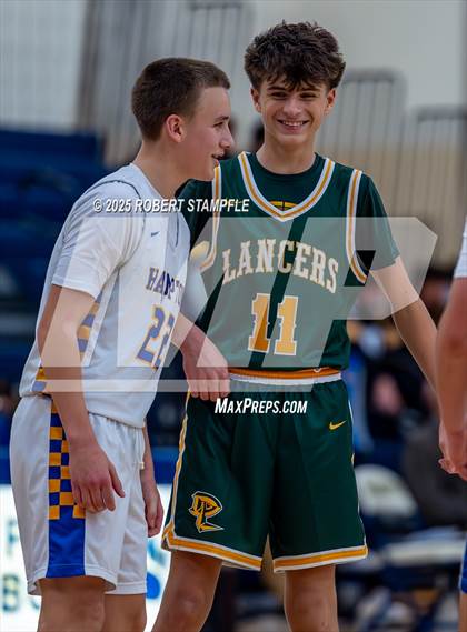 Thumbnail 1 in JV: Deer Lakes @ Hampton photogallery.