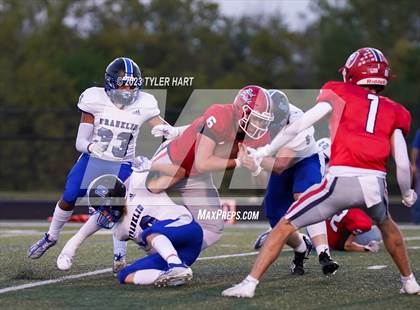 Thumbnail 3 in Franklin Community @ Plainfield photogallery.