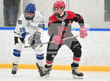 Thumbnail 3 in Conard @ Southington/Coginchaug/Westbrook photogallery.