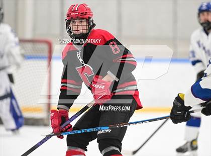 Thumbnail 2 in Conard @ Southington/Coginchaug/Westbrook photogallery.