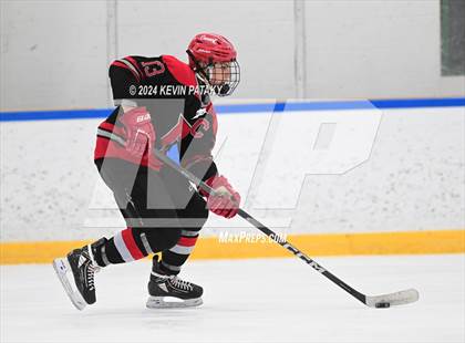Thumbnail 1 in Conard @ Southington/Coginchaug/Westbrook photogallery.