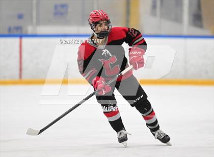 Thumbnail 1 in Conard @ Southington/Coginchaug/Westbrook photogallery.