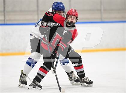Thumbnail 3 in Conard @ Southington/Coginchaug/Westbrook photogallery.