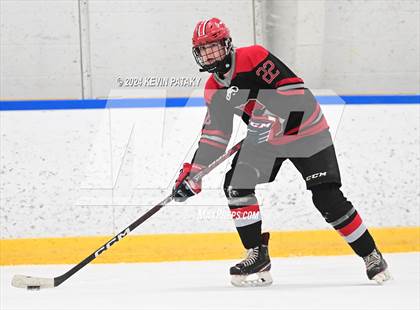Thumbnail 3 in Conard @ Southington/Coginchaug/Westbrook photogallery.